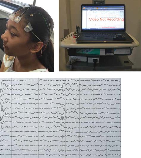 How to set up and record an EEG